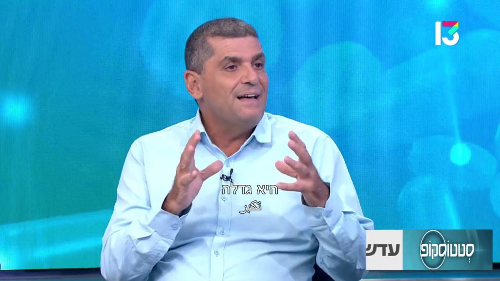 פרופ' מורד יאיר רופא עיניים מומחה פזילה וילדים